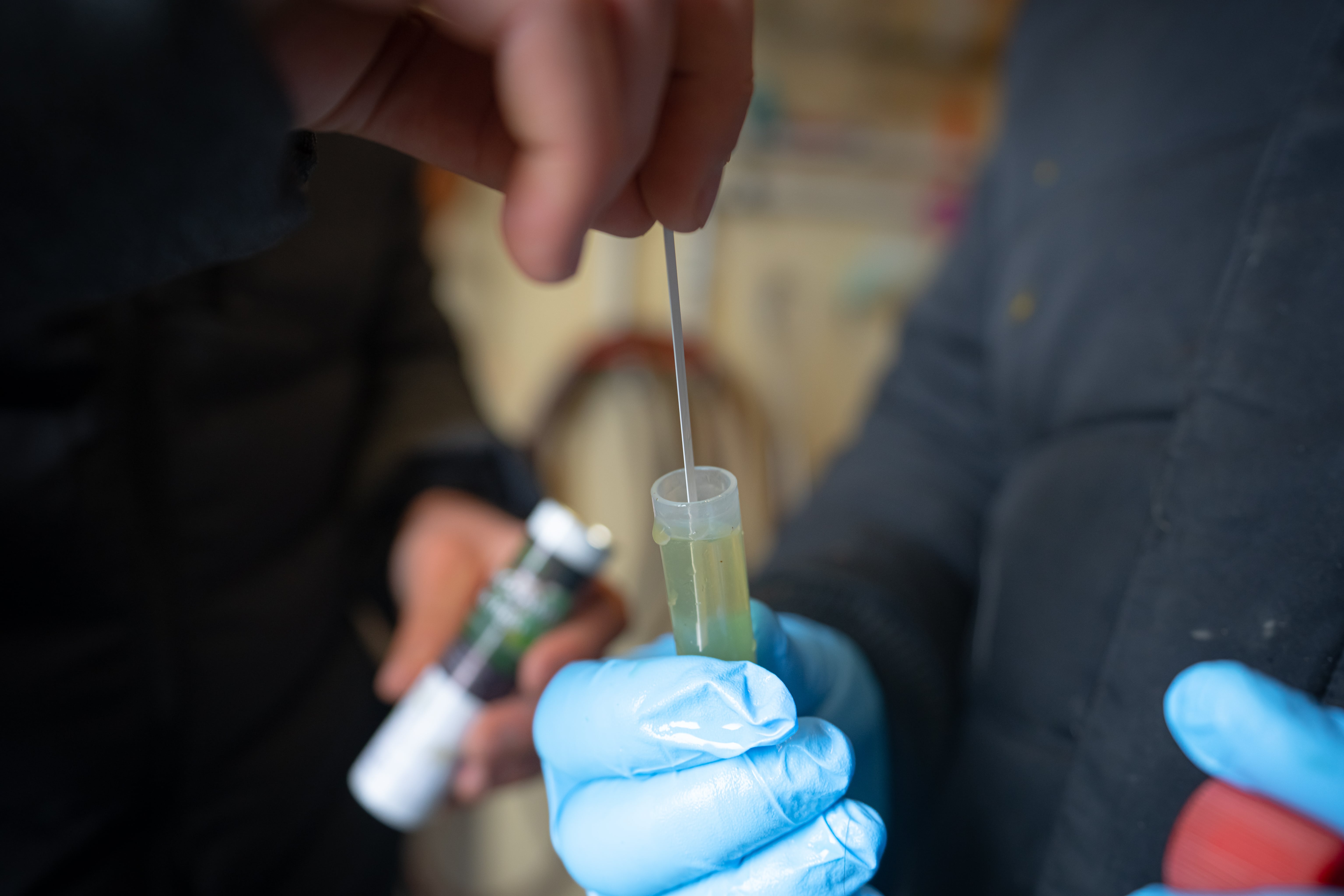 Durchführung eines Ketosetests